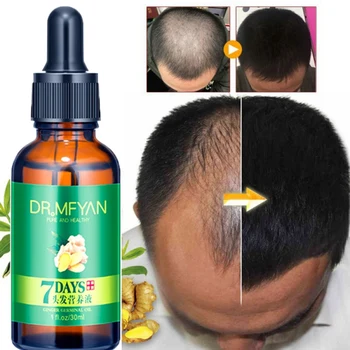 

Ginger Germinal Oil Nourishing Scalp Ginger Hair Growth Oil Anti-hair Loose Hair Regrowth Essential Oil