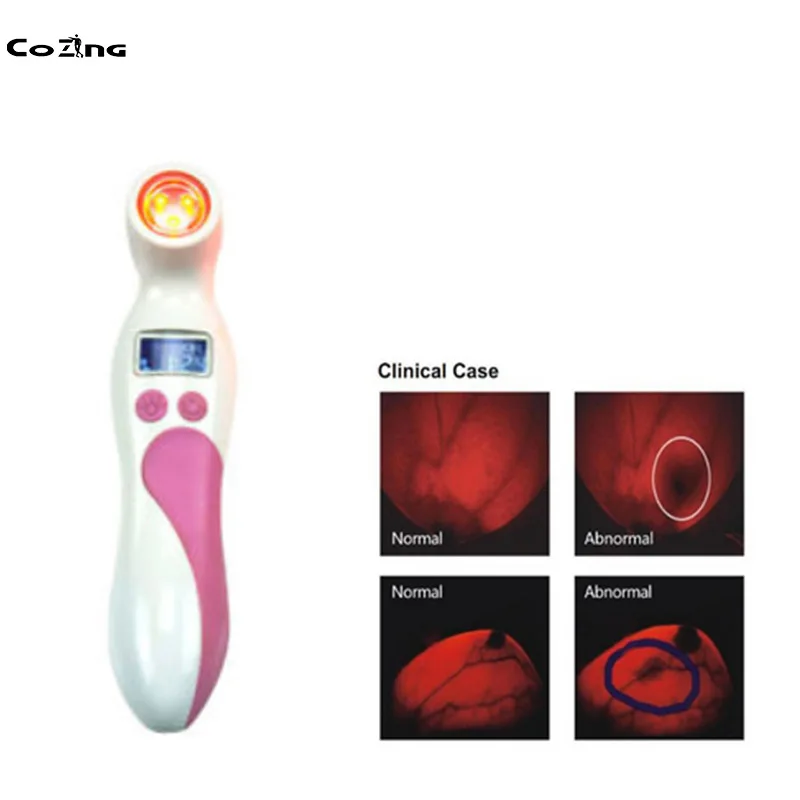 

Portable Breast Cancer Analyzer Breast Lump Check Detector Women Home Use