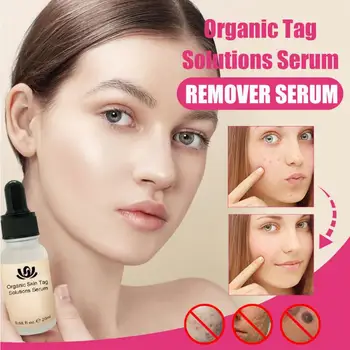 

20ml Tags Solutions Serum Painless Mole Dark Spot Remover Serum Face Wart Tag Freckle Removal Cream Moisturizing Face Skin Care