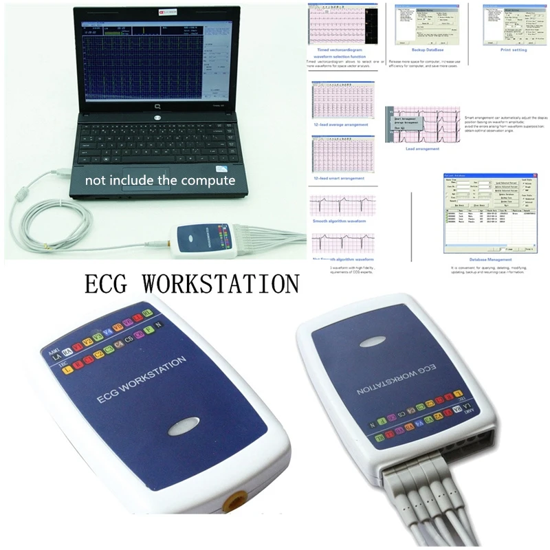 CE CONTEC8000G абсолютно новая рабочая станция ECG на основе 12 свинцовых анализаторов
