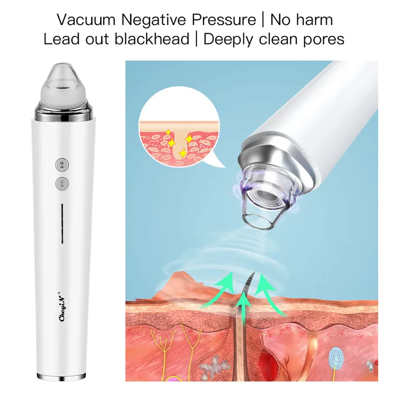 US $31.55 WiFi Camera Visual Face Blackhead Remover Vacuum Suction Pore Cleaner Face Deep Nose Cleasning Pimple Removal With 6 Heads Tool