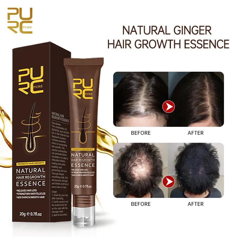 Purc Natural Hair Growth Oil Thickener Essence Anti Hairs Loss Care