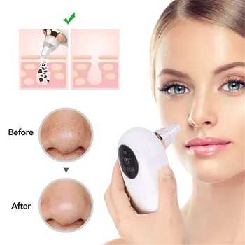 

Blackhead Remover Vacuum Pore Cleaner Suction Deep Cleaning Face Care Black Head Cleaner Acne Extractor Diamond Skin Care Tools