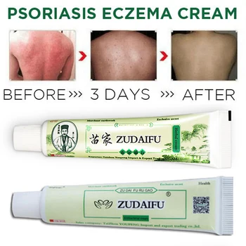 

Zudaifu Skin Psoriasis Cream Dermatitis Eczematoid Eczema Ointment Treatment Psoriasis Cream Skin Care Body Cream