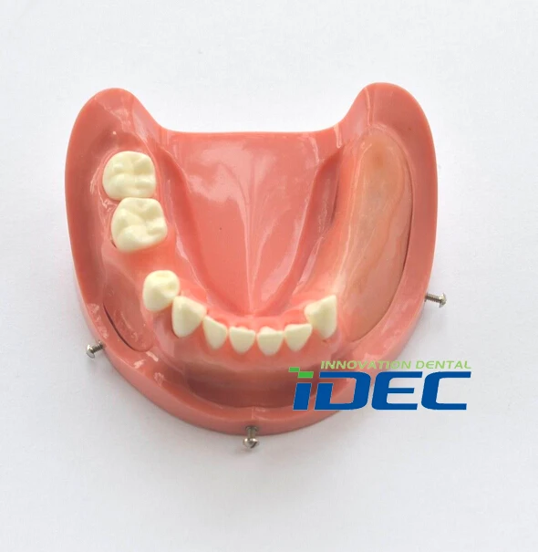 

Dental Teeth Model Lower Jaw Implant Practice Model #2003