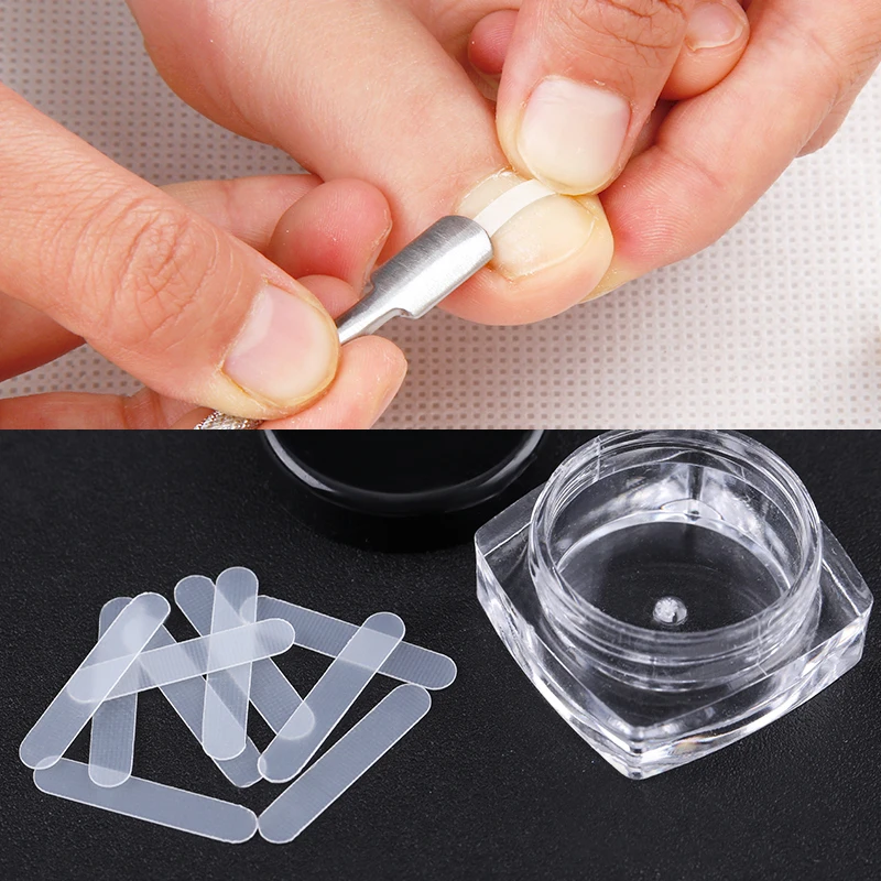 

10pcs/Box Nail Correction Ingrown Toe Sticker Patch Fixer Pedicure Correction File Corrector For Foot Care Toe Nail Tool