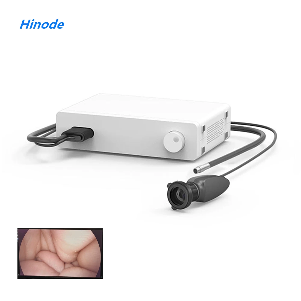 

HD 4K Medical Surgery Integrated Endoscope Video Camera LED Cold Light source