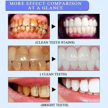

Waterproof Clean Mouth Family Electric Toothbrush Oral Dental Care Plastic USB Charging 3 Colors Intelligent Toothbrush