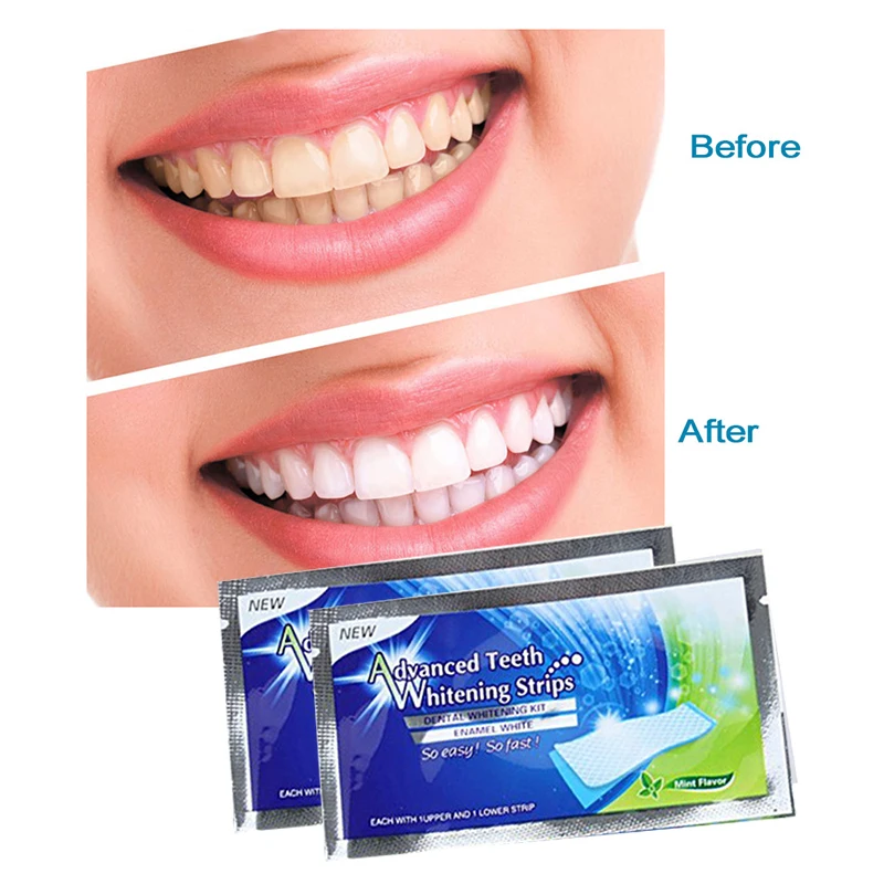 

Teeth Whitening Strips White Tooth Dental kit Oral Hygiene Care Double Elastic Teeth Strip Whiten Gel Dental Bleaching Tools