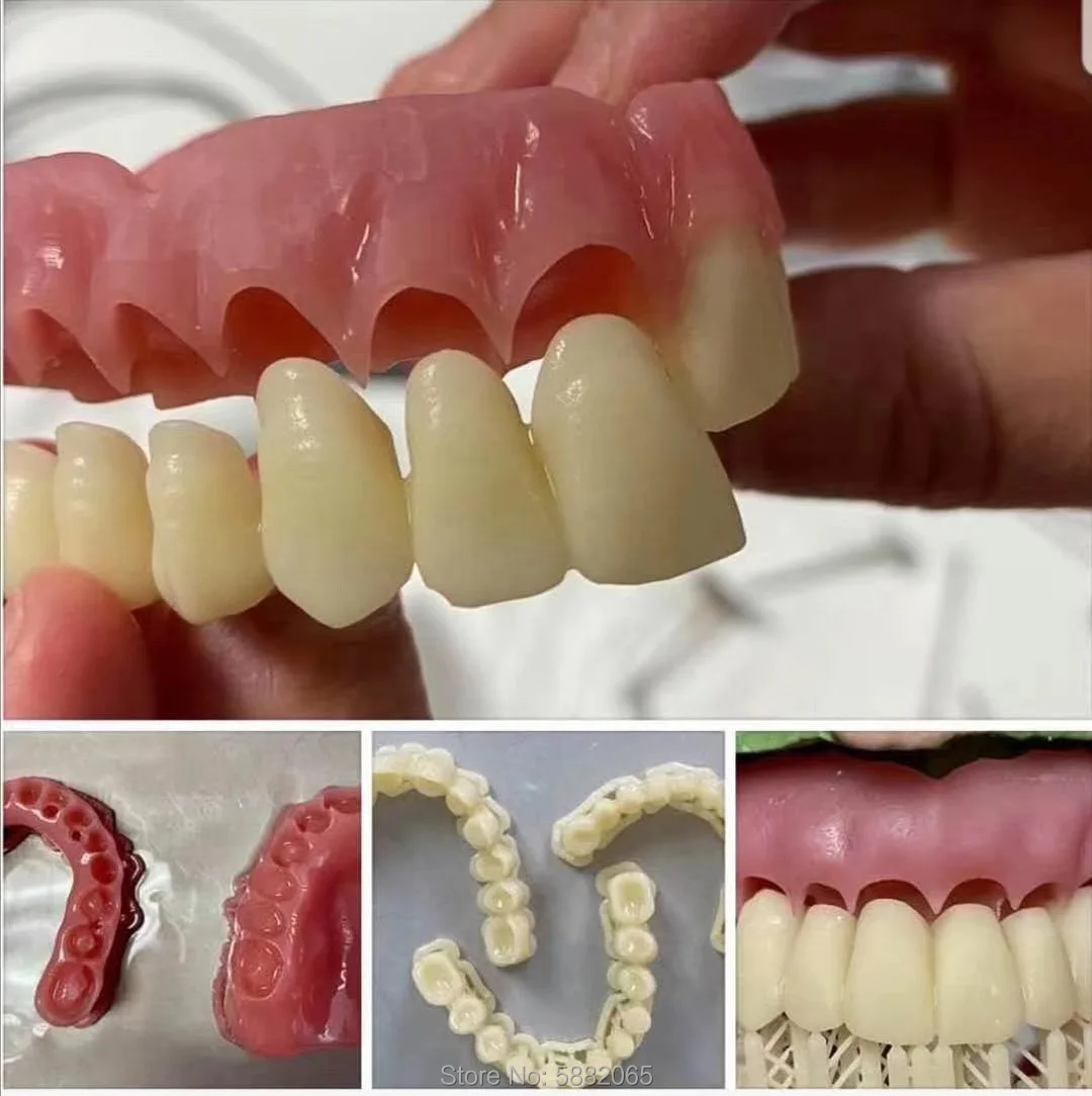 의치 베이스 임시 치아 감광성 수지 3D 프린터 흡착 옥타라이트 샤이닝 NOVA3D 1000ML, 405nm, 무료 배송