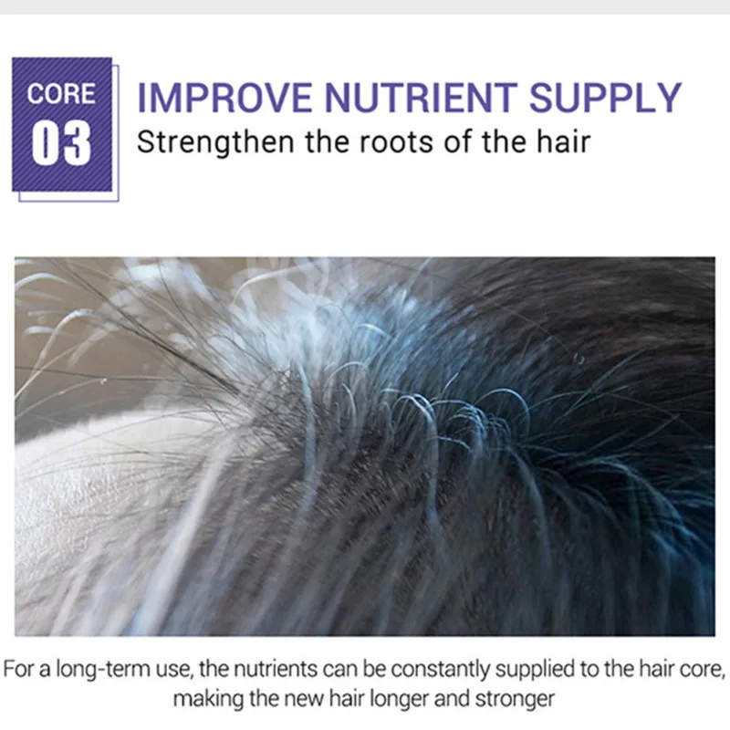 30 мл имбирное эфирное масло для роста волос питает волосяные фолликулы против выпадения волос масло для ухода за волосами