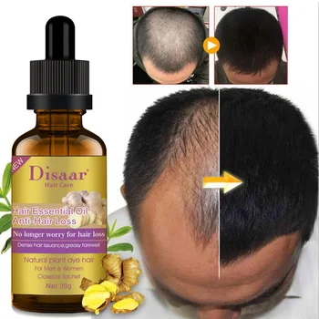 

Ginger Hair Essential Oil Repair Fork Anti-Peeling Hair Care Strong Oil Control Split Care Essential Oil