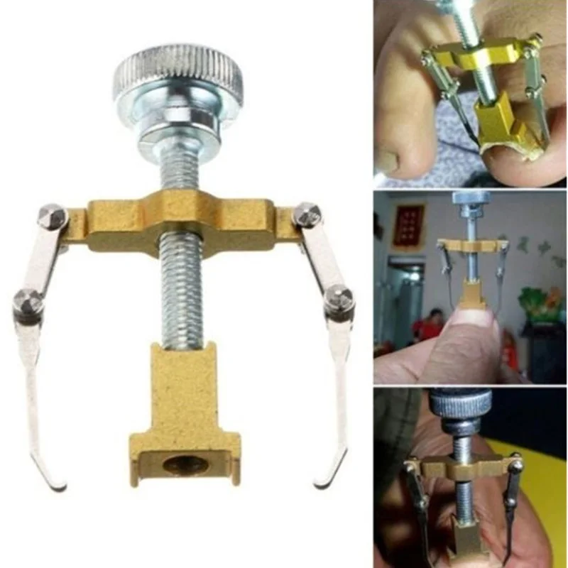 

1Pc Ingrown Toe Nail Fixer Correction Tool Fixer Recover Toe Paronychia Nail Brace Tool Toenails Foot Pedicure Recover Care Tool