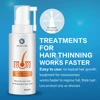 HAIRCUBE Hair Growth Spray Anti Hair Loss Serum for Fast Hair Growth Treatment Oil Hair Tonic Hair Care Hair Loss Products ► Photo 3/6