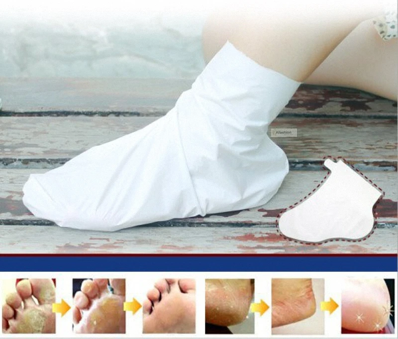 Share 150+ foot skin peel bags best 3tdesign.edu.vn