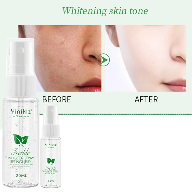 Freckle Removal Serum Moisturizing Lightening Pigment Brighten Skin Color Anti-aging Spray Bright White Pigment SkinCare