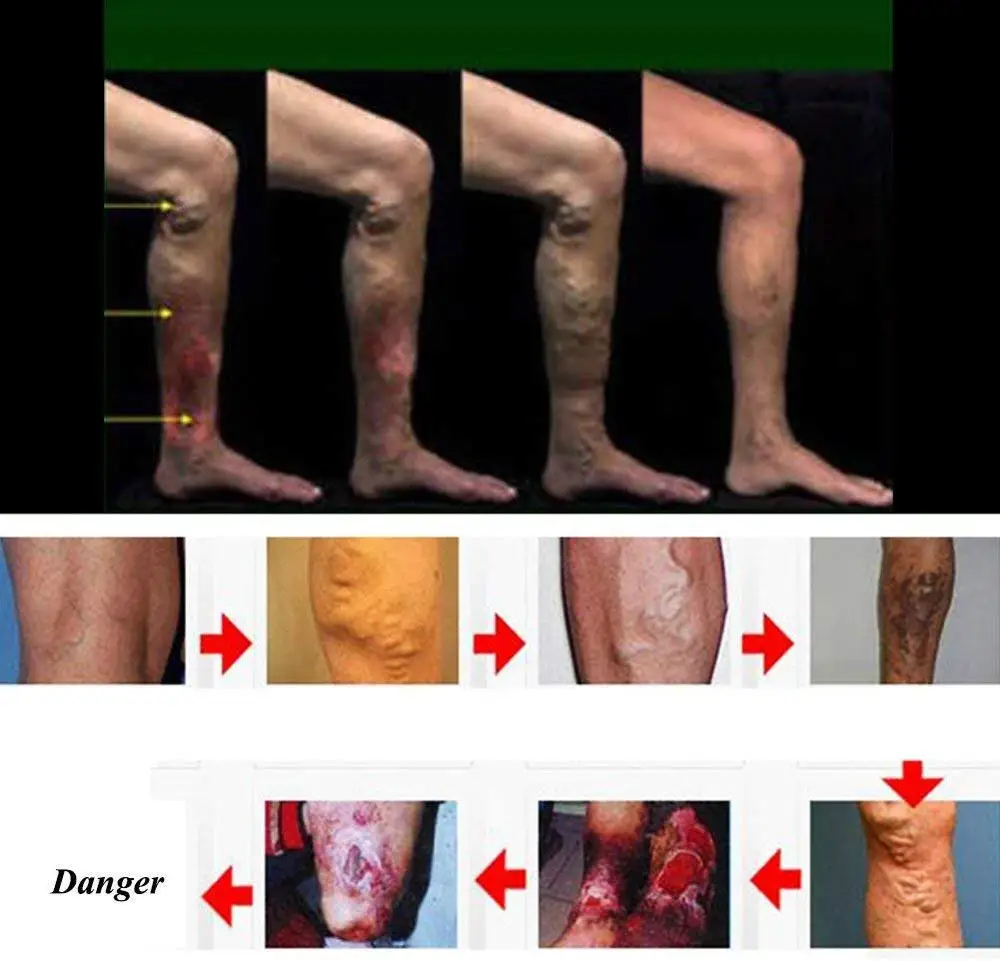 PBE_0AOU_spu_extend_images_other_1688_4