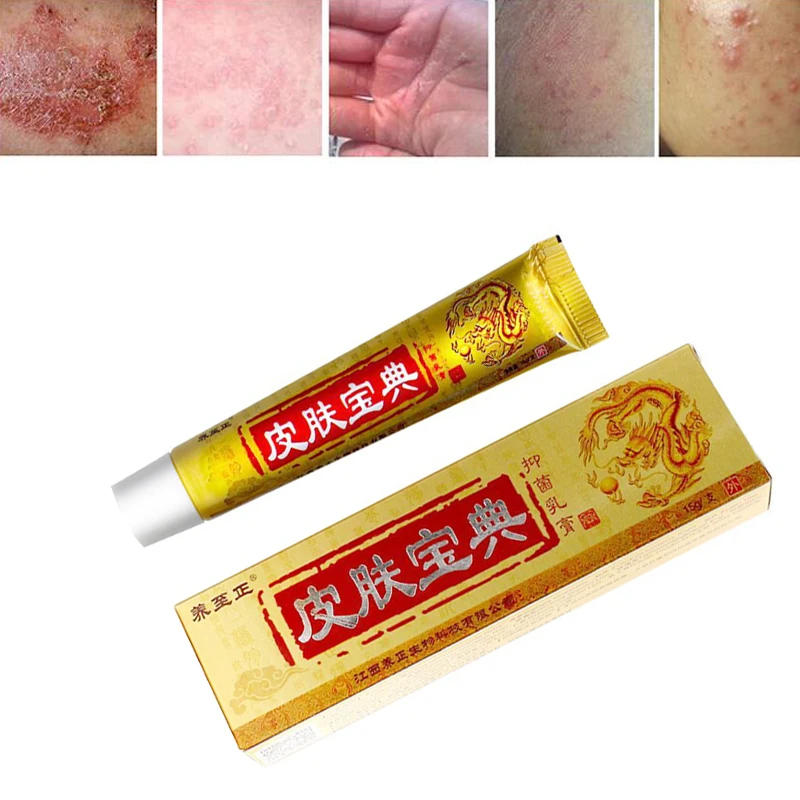 3 шт., китайская медицина, крем, псориаз, дерматит, Eczema Pruritus, проблемы с кожей, снимает кожу, мазь против зуда