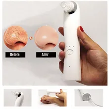 Черное очищающее средство от черных точек очиститель пор черный точечный аппарат для чистки лица черные точки пятна и средство для устранения черных точек для лица