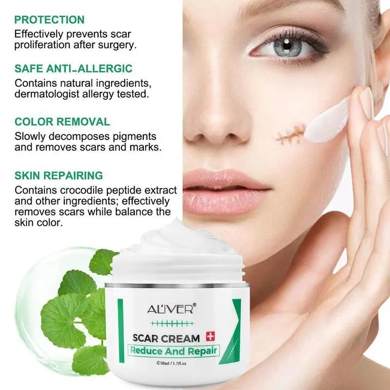 

Advanced Treatment for Face & Body Old & New Scars From Cuts, Stretch Marks, C-Pieces & Operations Scar Removal Cream