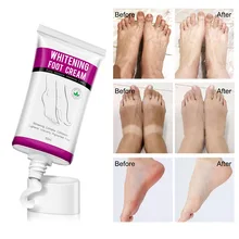 new ALIVER Foot Cream Whitening Cream Moisturizing Care Moisturize Foot Skin Cream Hydrating White Smooth And Delicate Foot Care
