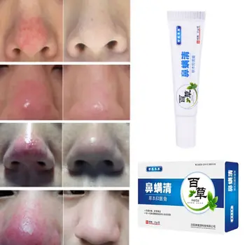 

15g Mites Treatment Cream Nose Redness Removal Cleaning Antibacterial Repair Gel Shrink Pores Skin Care Product