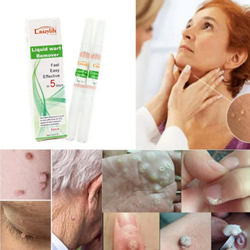 Remove Old Sputum To Remove Dead Skin Pen To Beautify Skin Care