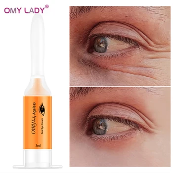 

OMY LADY Eye Cream Anti-Wrinkle Anti-Age Remover Dark Circles Under Eye Moisturizing Firming Eye Care Against Puffiness And Bags
