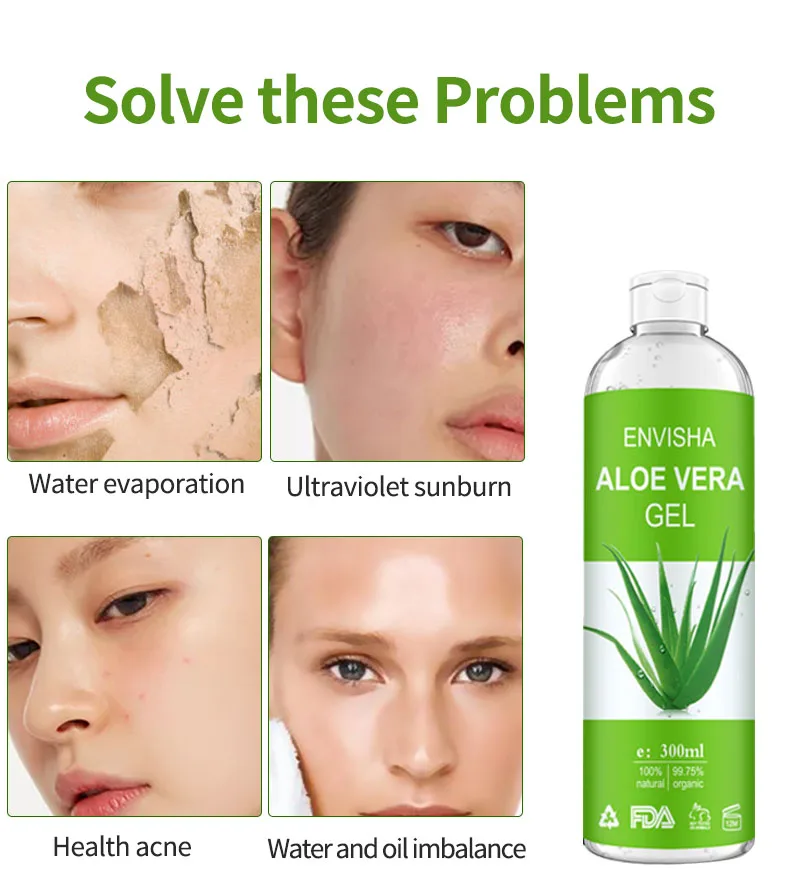 Envisha Aloe Soothing Moisturizing Hyaluronic Acid Sunburn Repairing Treatment Skin Face Body Cream Antipruritic - After Sun Lotions - AliExpress