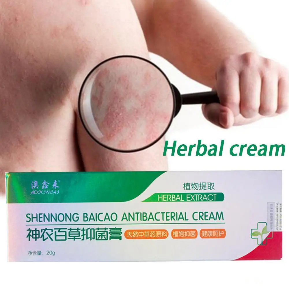 20 г натуральный присущая средствам китайской медицины травяной псориаз экзема мазь лечение высокое качество травяной крем