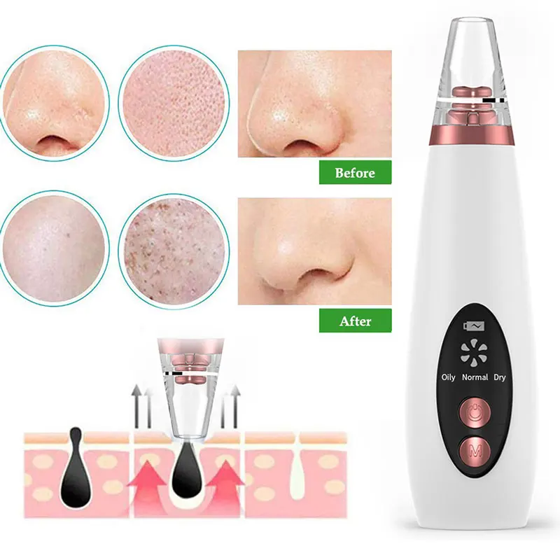 

ABS Black Head Cleaner Facial Cleaning Fast Acne Cleaner Blackhead Removal Equipment Cosmetic Instrument Fashion Beauty Health