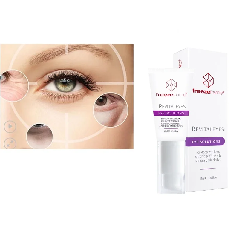 freezeframe revitaleyes