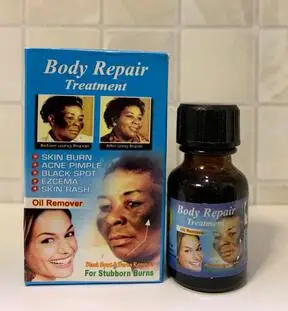 

Body Repair Treatment Oil Spot Remover knuckle AFRIWORLD
