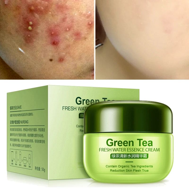 skin 101 anti acne cream