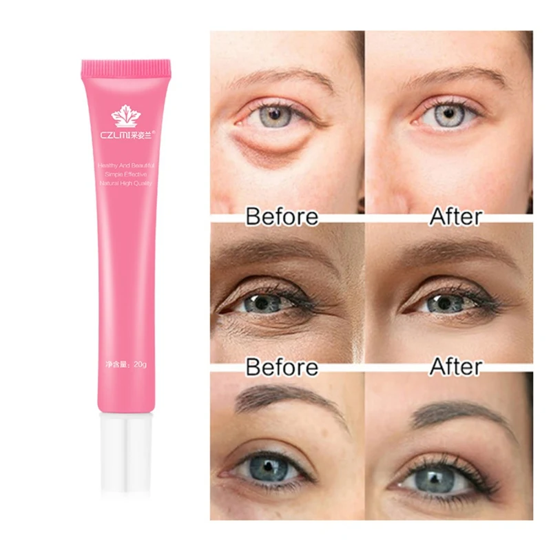 

NEW!!Eye Cream Eyes Serum Moisturizing Ageless Anti Wrinkle Firming Whitening Skin Care Remove eye bags dark circles fine lines