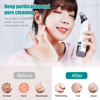 

Home Suction LCD Display Skin Care Gift Electric Blackhead Remover ABS Pore Vacuum Extractor Facial Tool USB Rechargeable Pimple