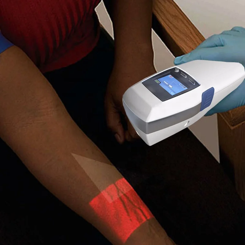 High Quality Portable Hospital Clinic Infrared Accu Vein Finder Detector