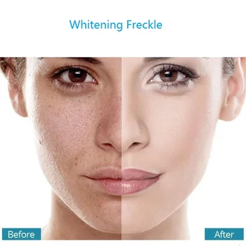 Effective Whitening Freckle Cream Remove Dark Spots Anti Freckle Cream