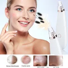 Средство для удаления угрей лица глубокое очищение поры, акне Удаление прыщей вакуумное всасывание лица алмаз красота чистая уход за кожей Инструмент для спа