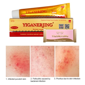 

For Yiganerjing/Damangren Original Psoriasis Dermatitis Eczema Pruritus Skin Problems Cream for ZUDAIFU Free Antibacterial Soap