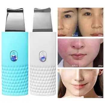 

Electric Ultrasonic Blackhead Remover Facial Beauty Device Pore Cleasning Tool