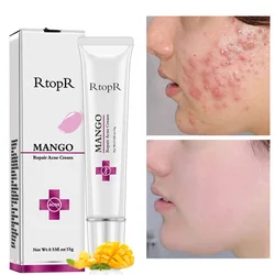 New Effective Acne Removal Cream Herbal Anti-acne Repair Fade Acne Spots Oil Control Whitening Moisturizing Face Gel Skin Care