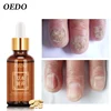 Herbal Fungal Nail Treatment Essential oil Hand and Foot Whitening Toe Nail Fungus Removal Infection Feet Care Polish Nail Gel ► Photo 2/6