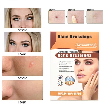 

36pcs Acne Patch Treatment Skin Tag Remover Pimple Master Invisible Acne Stickers Patch Concealer Tags Dropshipping TSLM1