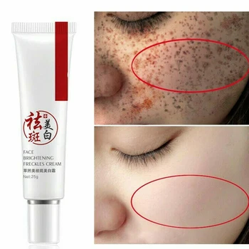 

Hyaluronic Acid Anti Aging Face Care Moisturizing Freckle Cream Portable Dark Circles Easy Apply Brightening Home Stains Remove