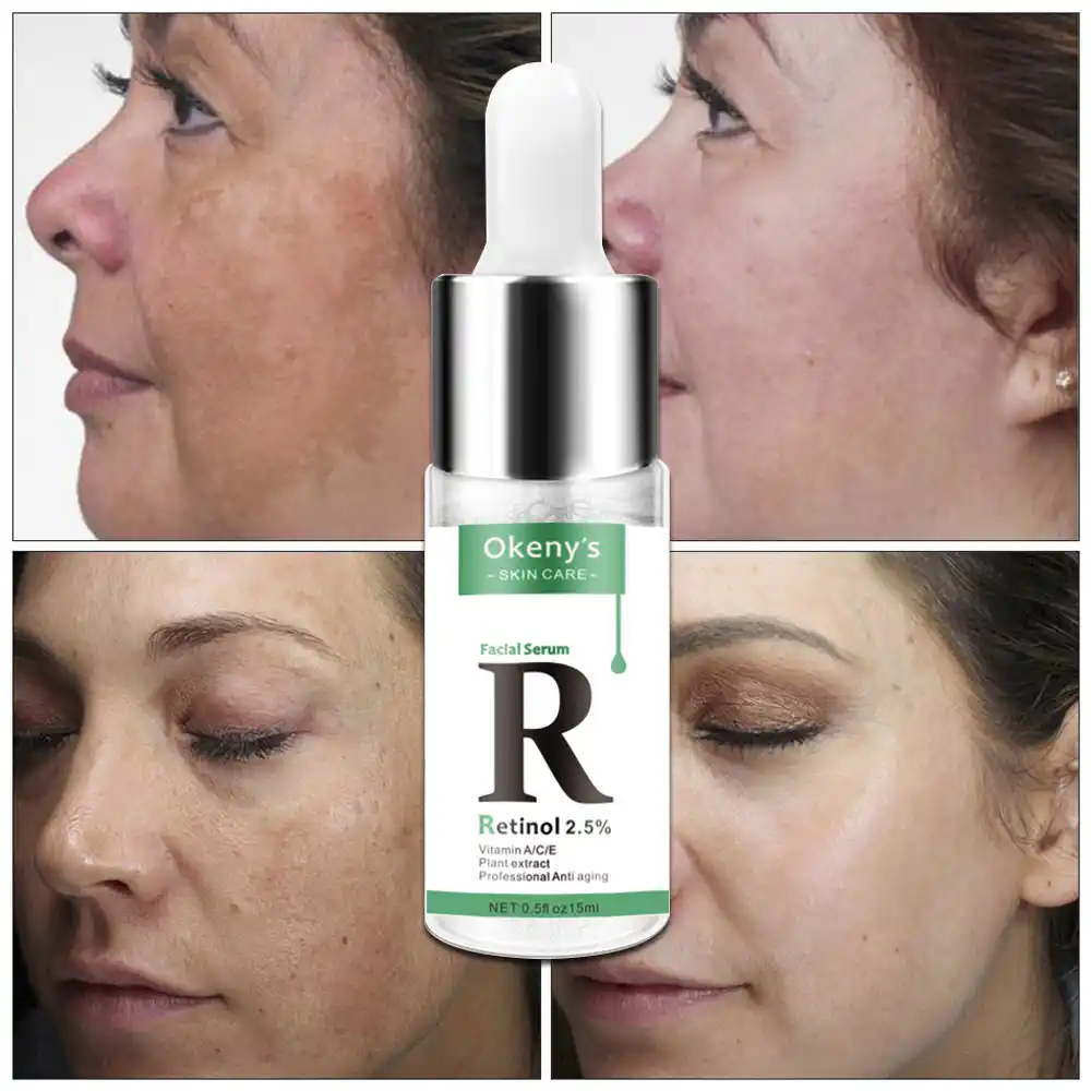 retinol for dark spots
