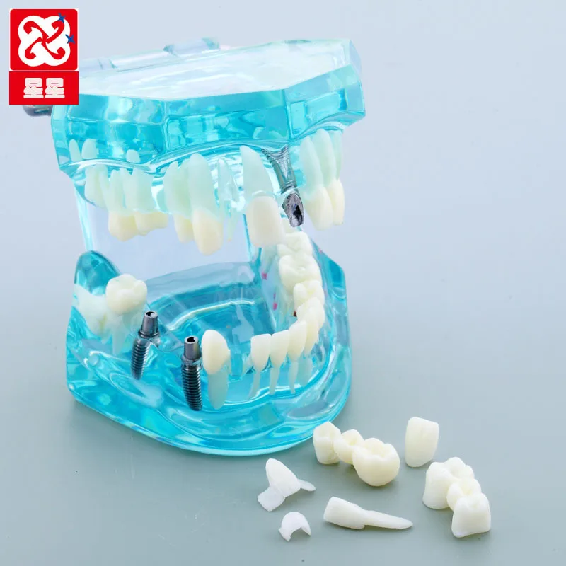 Взрослая Стоматологическая модель восстановления смолы модель исследования зубов стоматолога инструменты стоматология лаборатория прозрачная модель