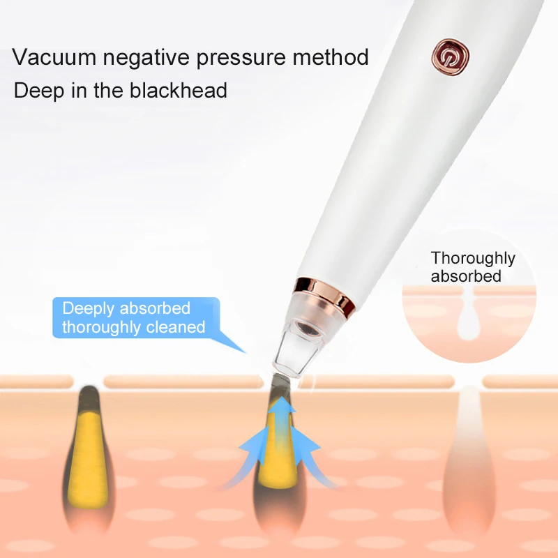 Средство для удаления черных точек лица, глубокое очищение пор, Удаление прыщей, вакуумное Очищение лица, спа, алмазные средства по уходу за кожей