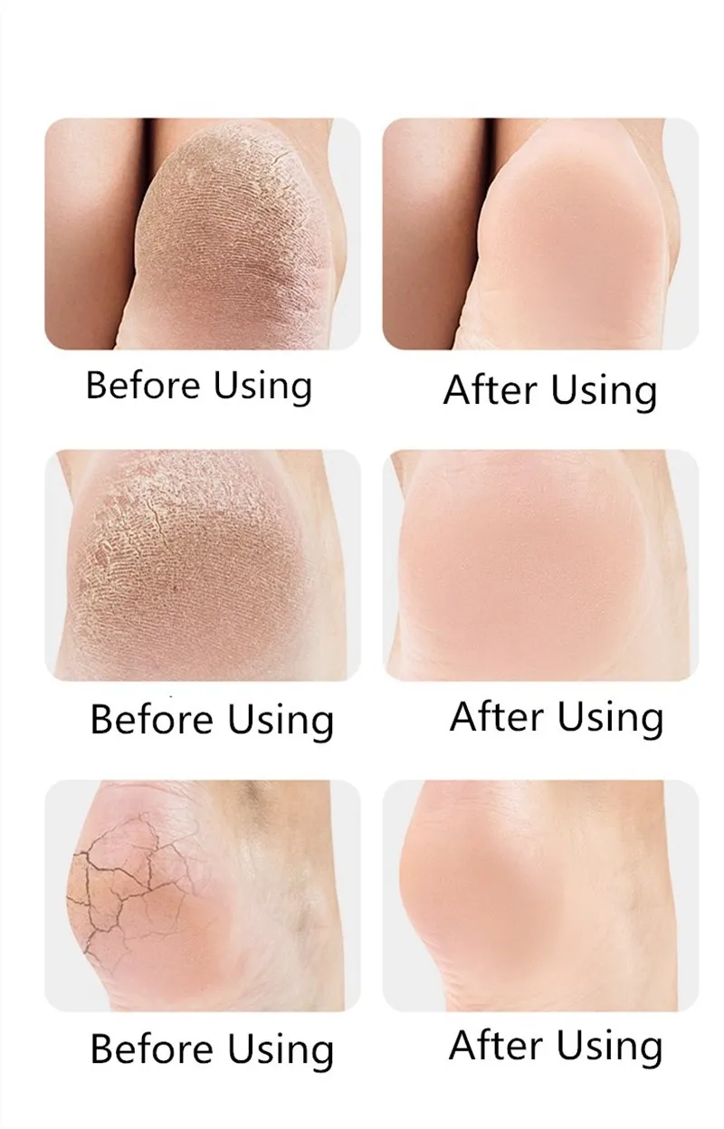 2 Pieces Heel Protector Protective Sleeve Heel Spur Pads for Relief Plantar Fasciitis Heel Pain Reduce Pressure on Heel