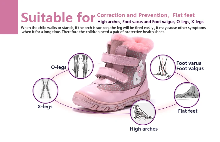 Princepard/100% натуральная меховая обувь из натуральной кожи для девочек, размеры 22-28, новинка 2018, розовая Зимняя ортопедическая обувь для детей